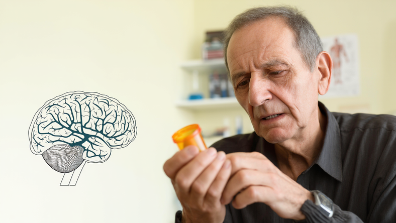 帕金森病为何没有特效药?